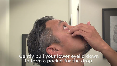 How to Put in Eye Drops